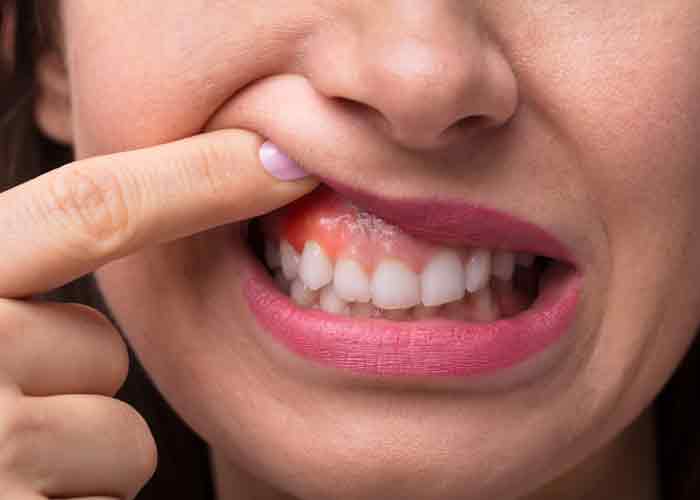 True balance dental preventive