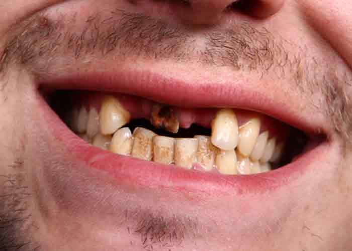 True balance dental loose teeth