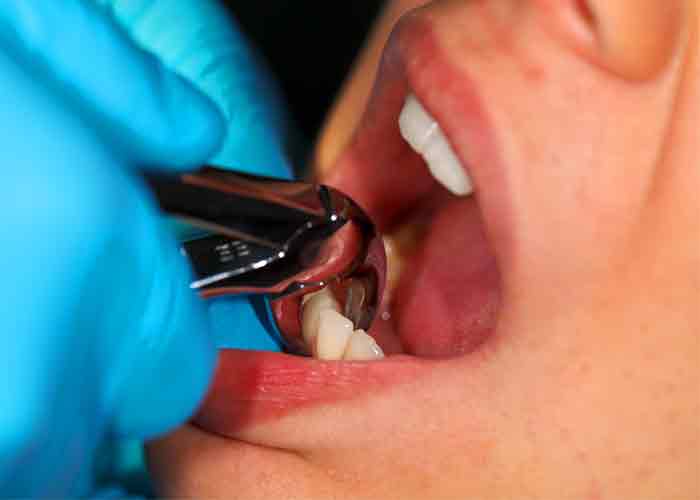 True balance dental preventive